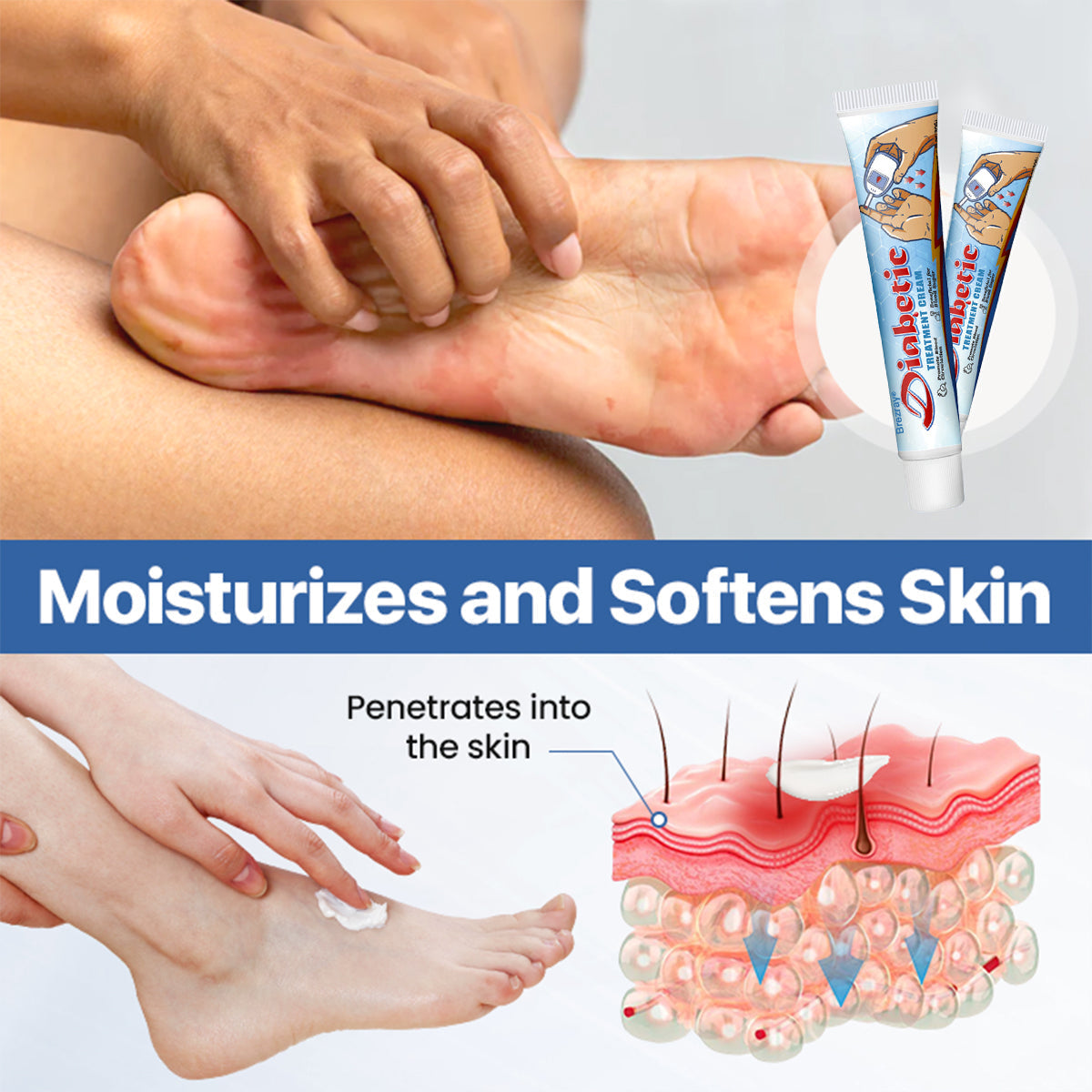 ⏰Limited Stock🔥Flash Sale 70% OFF🔥Brezray® VitaGluco Diabetes Treatment Cream