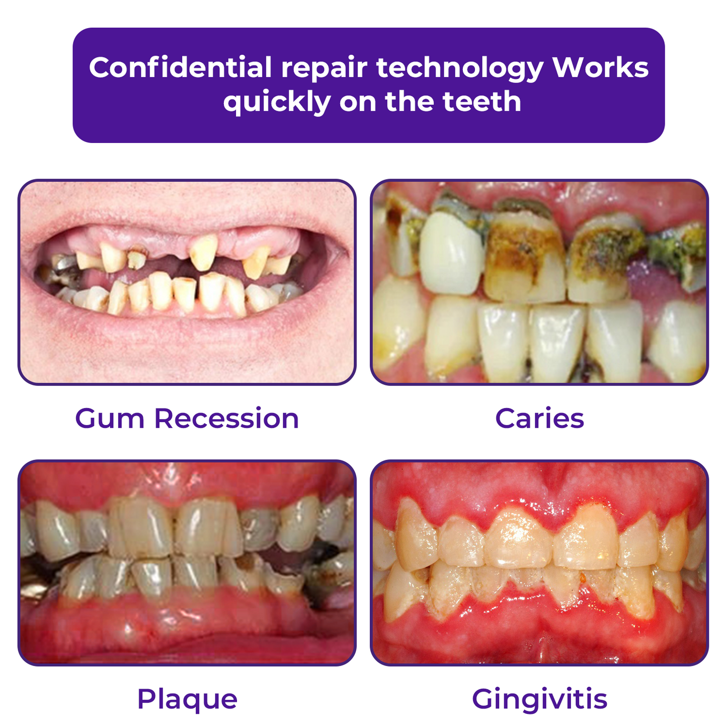š¦·LOVILDS⢠Dental Repair Mineral Powder >> š„Buy 1 Get 1 Freeš„