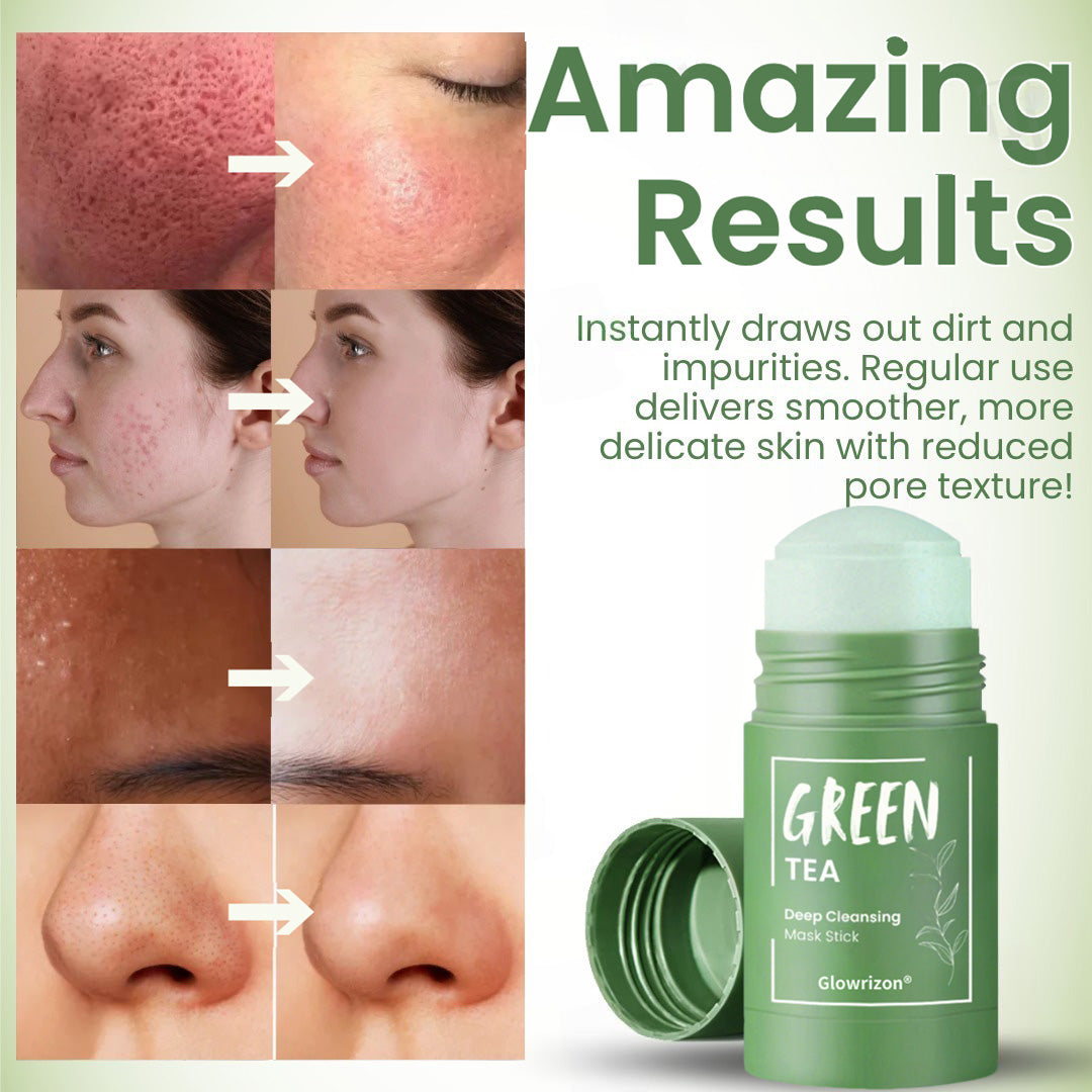 Glowrizonยฎ Green Tea Deep Cleansing Mask Stick (๐๐% ๐๐ฝ๐ฝ ๐๐ก๐๐ฆ ๐๐ก ๐ญ๐ฌ ๐ ๐๐ก๐จ๐ง๐๐ฆ)