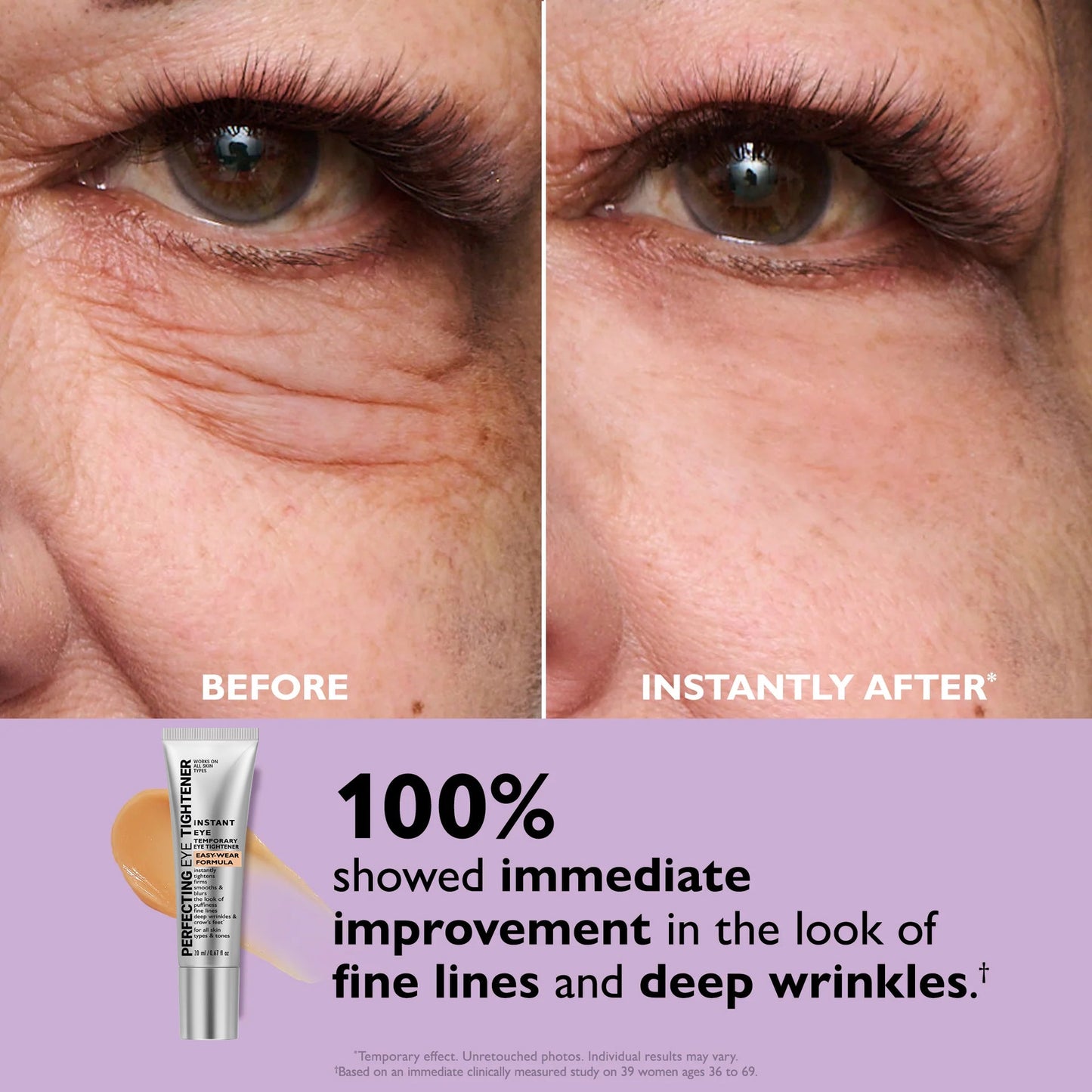 🌸[Official Store] 🌸 Instant Ageless Repair Serum | Visibly Tighter in 60 seconds. Lasts All Day.